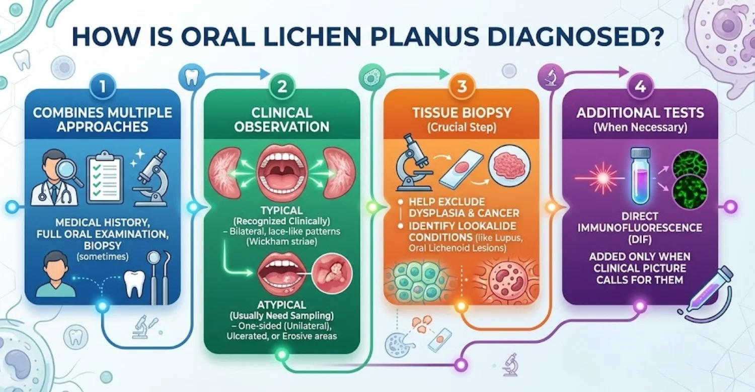 infographic oral lichen planus